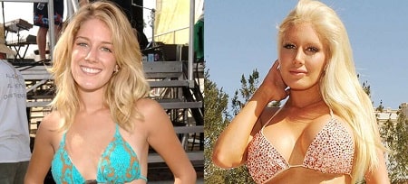 A picture of Tara Reid before (left) and after (right).